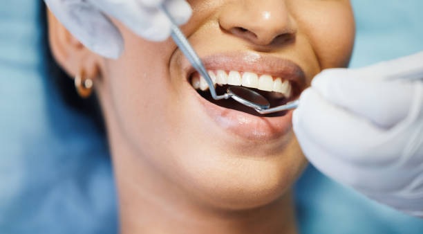 Restorative Dentistry San Francisco & West Portal